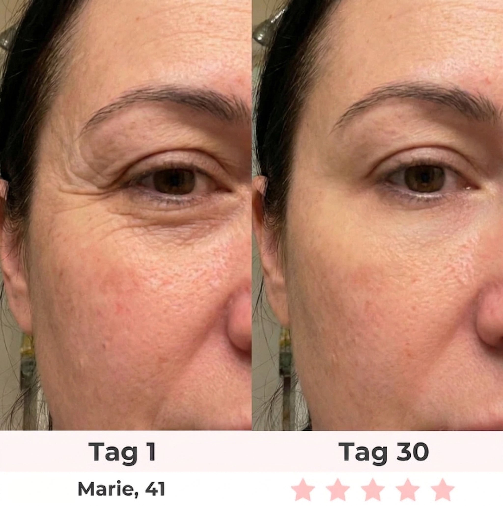 Rosevie 7-in-1 LED Gesichtssculptor